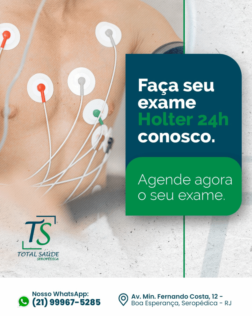 Holter 24h: para que serve, quem deve fazer e como o exame monitora seu coração