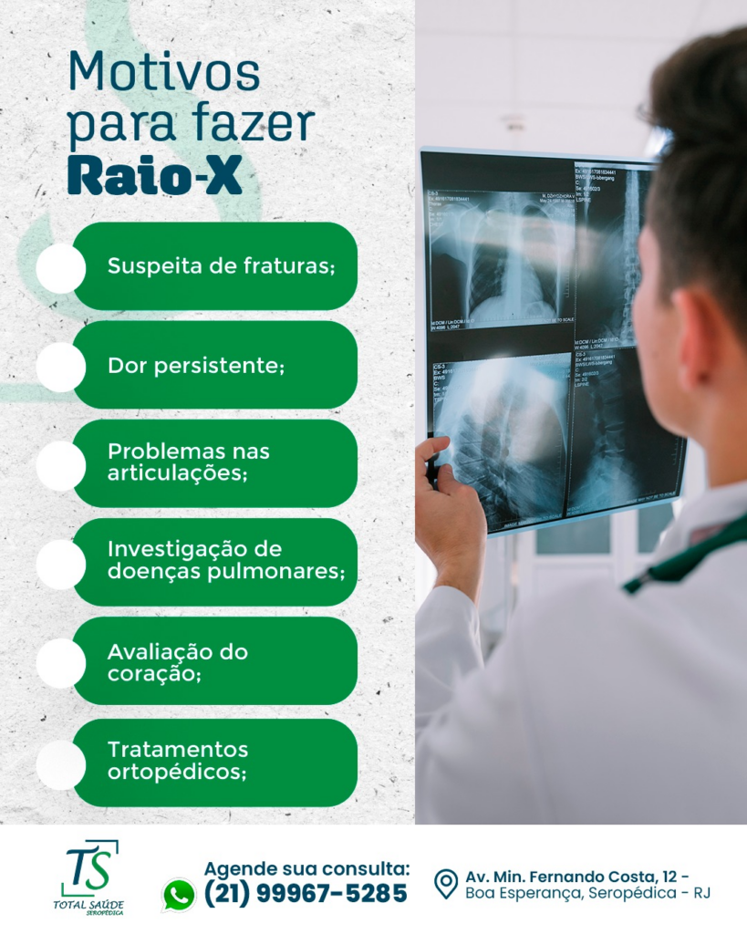 Quando o Raio-X é indicado? Entenda como esse exame pode ajudar no seu diagnóstico