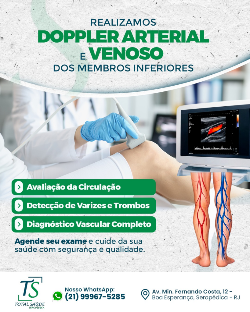 Doppler Arterial e Venoso das Pernas: exame essencial para avaliar a circulação