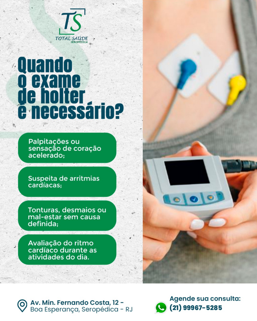 Holter 24h: exame para monitorar o ritmo do coração ao longo do dia